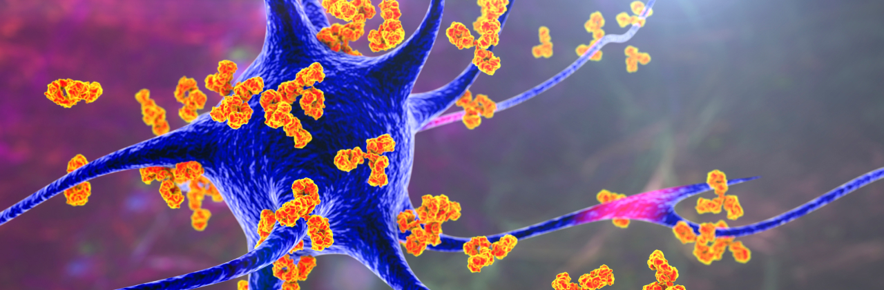 Antibodies attacking neurons in autoimmune neurologic diseases