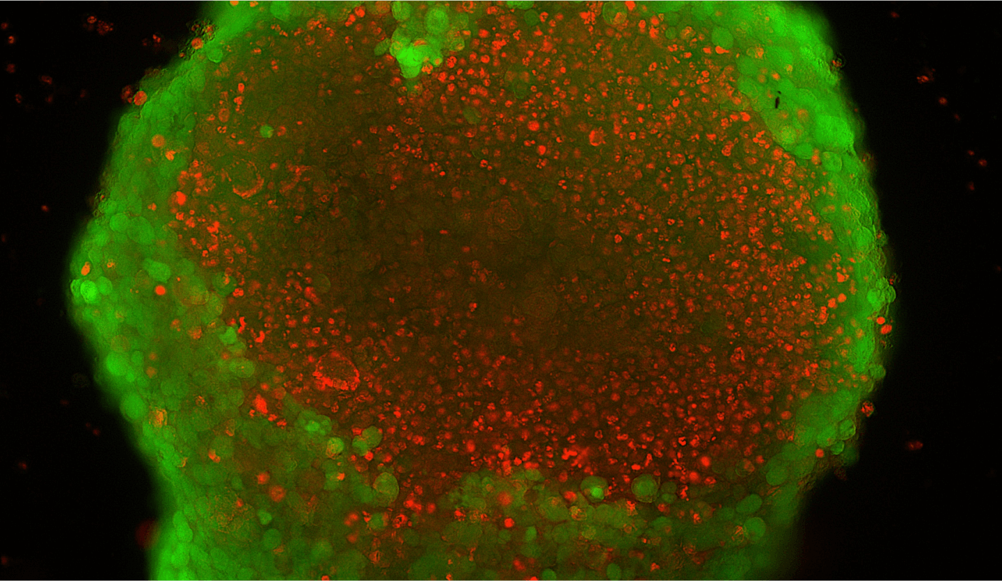 A fluorescent image showing the cellular morphology within a large organoids