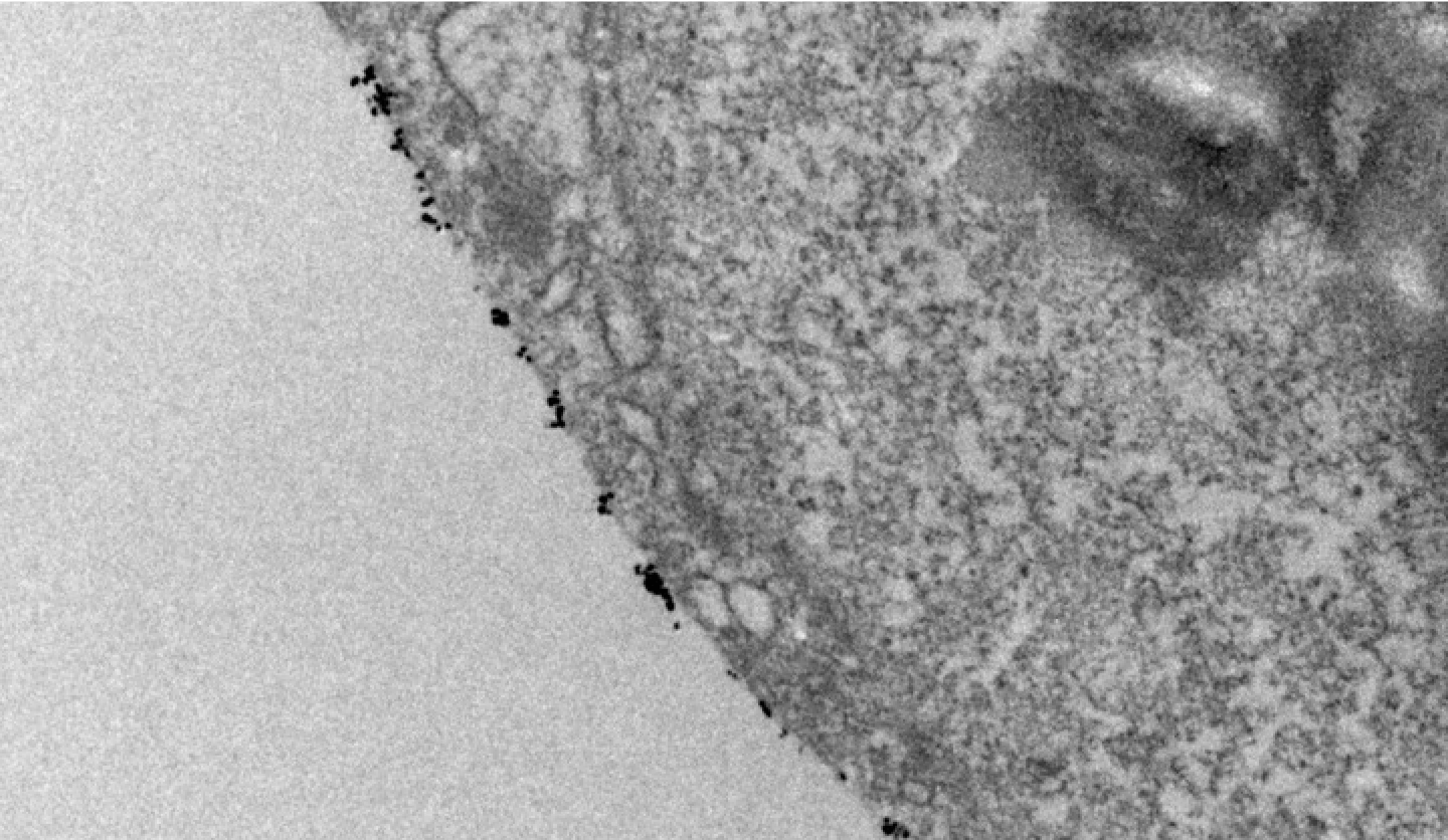 An electron microscopic picture of functionalized nanomaterials attached to the membrane of stem cells