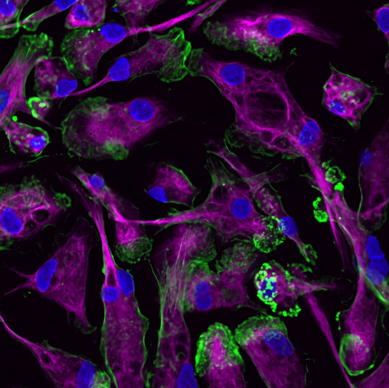 Human macrophages glow purple, blue, and green against a black background.