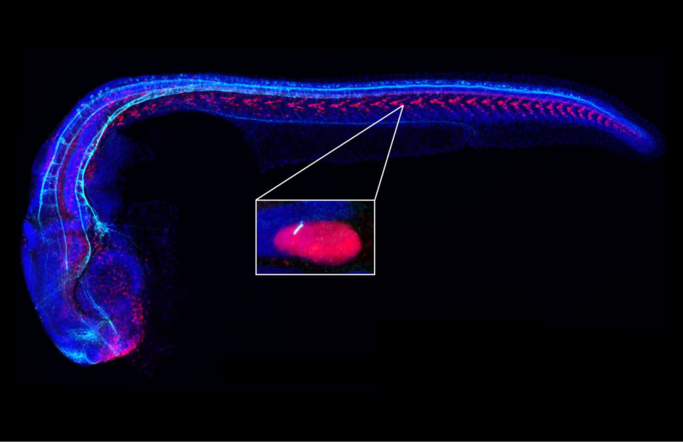 In the inset, a primary cilium (white) is seen protruding from a cell in a zebrafish embryo.