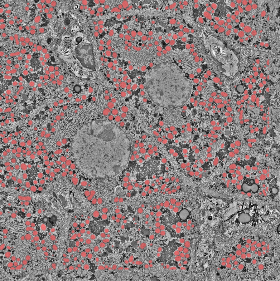 Many tiny red circles clustered together by grey lines, swirls and larger circles.